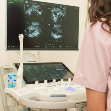 УЗД-апарати придбали за допомоги Тайваню для дитячої лікарні у Вінниці