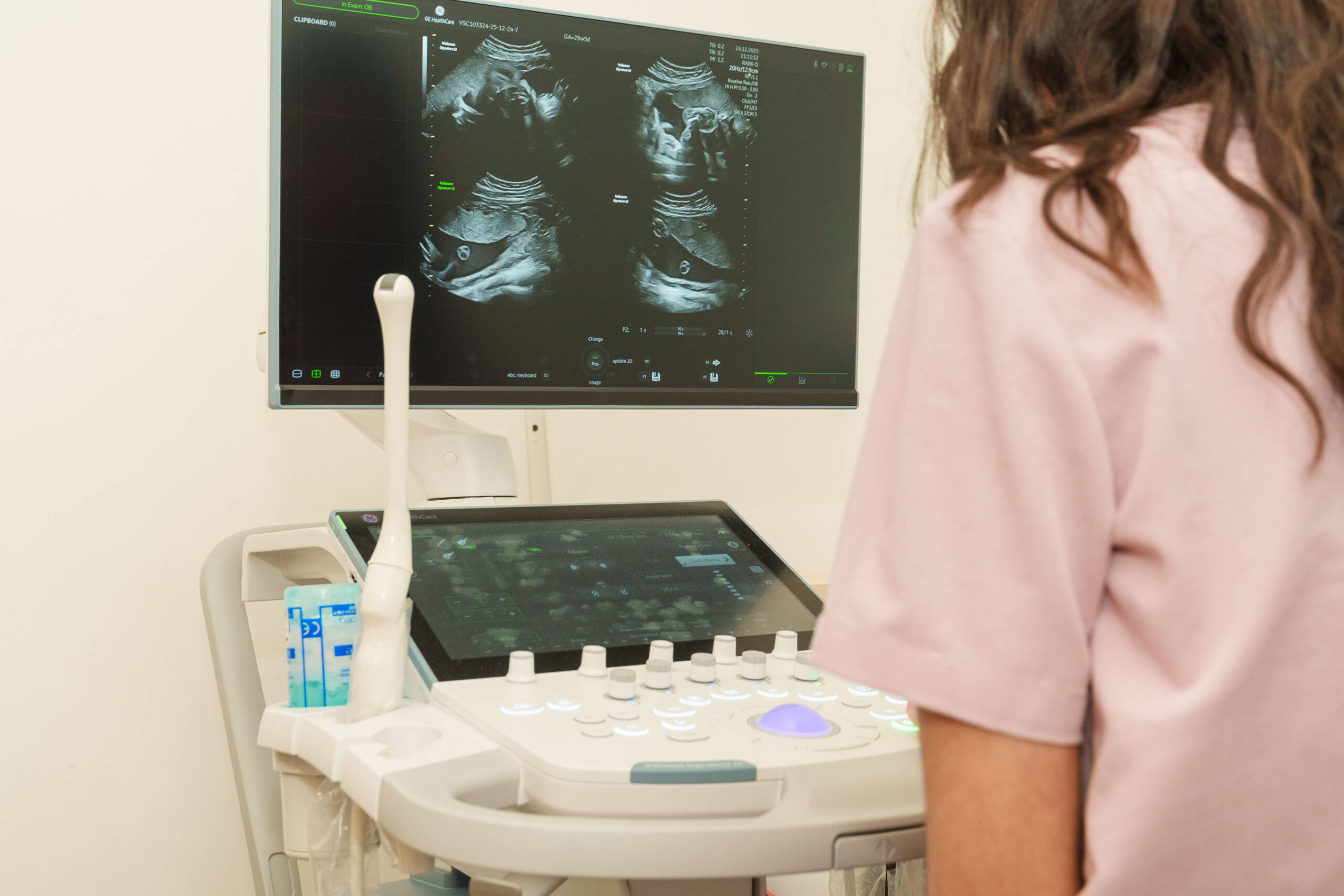 УЗД-апарати придбали за допомоги Тайваню для дитячої лікарні у Вінниці