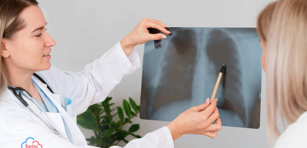 місто У січні на Вінниччині виявили нові випадки та рецидиви туберкульозу