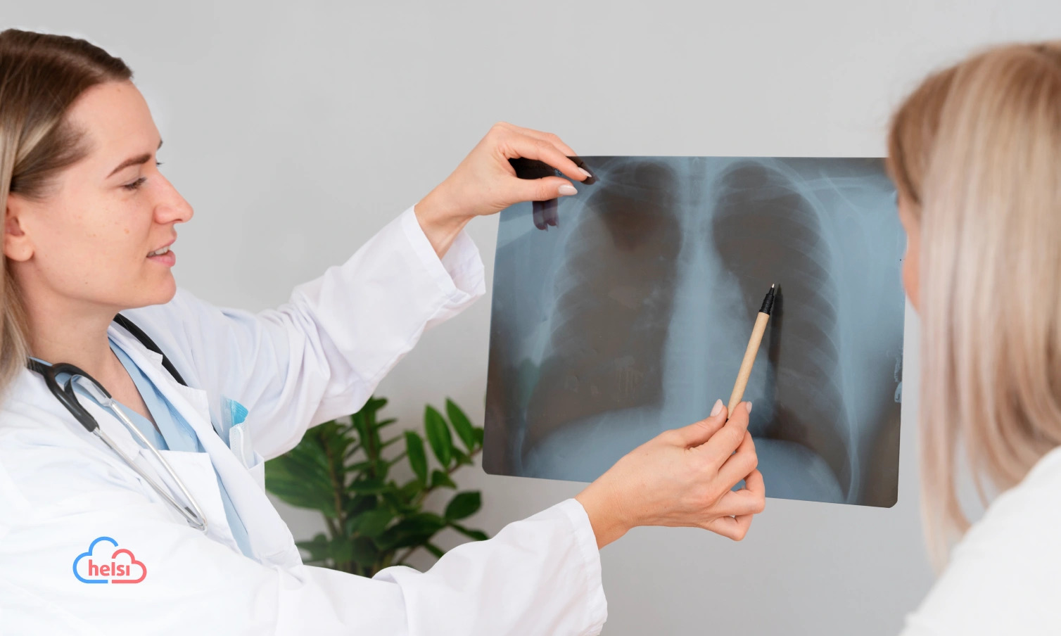 У січні на Вінниччині виявили нові випадки та рецидиви туберкульозу