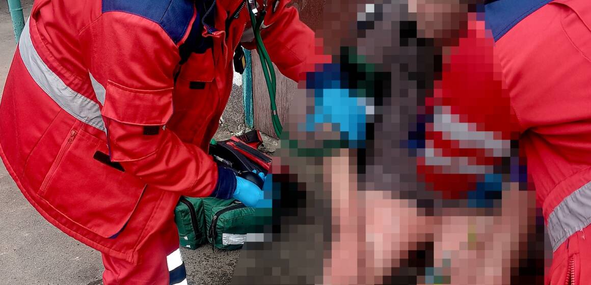 657753625_1423274653145420_3090876094665446180_n Спалювала траву та потрапила до лікарні з опіками пенсіонерка із Жмеринщини