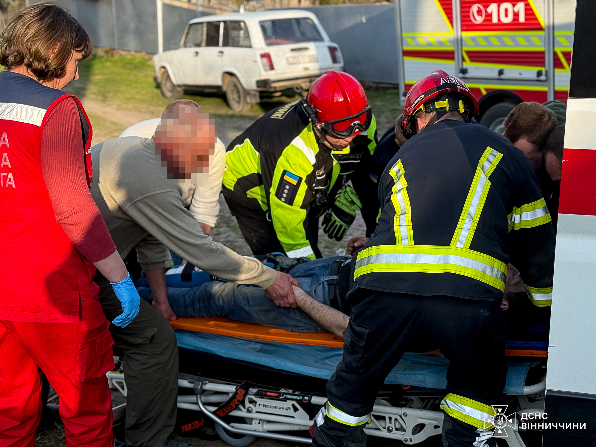 На Вінниччині чоловік травмувався під час роботи з мотоблоком