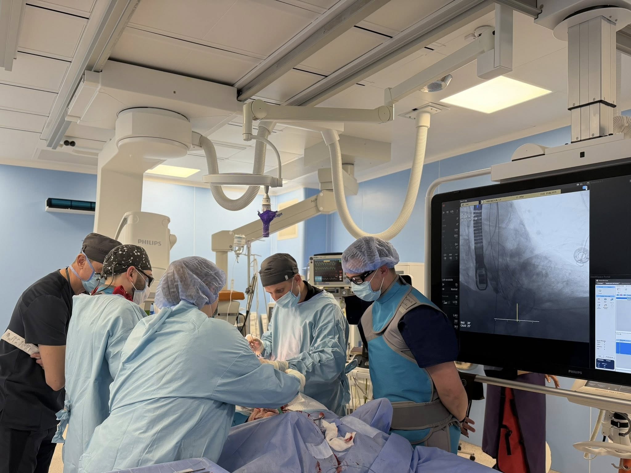 Серце під захистом: у Вінниці впровадили унікальну технологію заміни клапана через судину