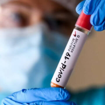 В Україні зафіксували новий штам коронавірусу «Цикада»: чим він загрожує