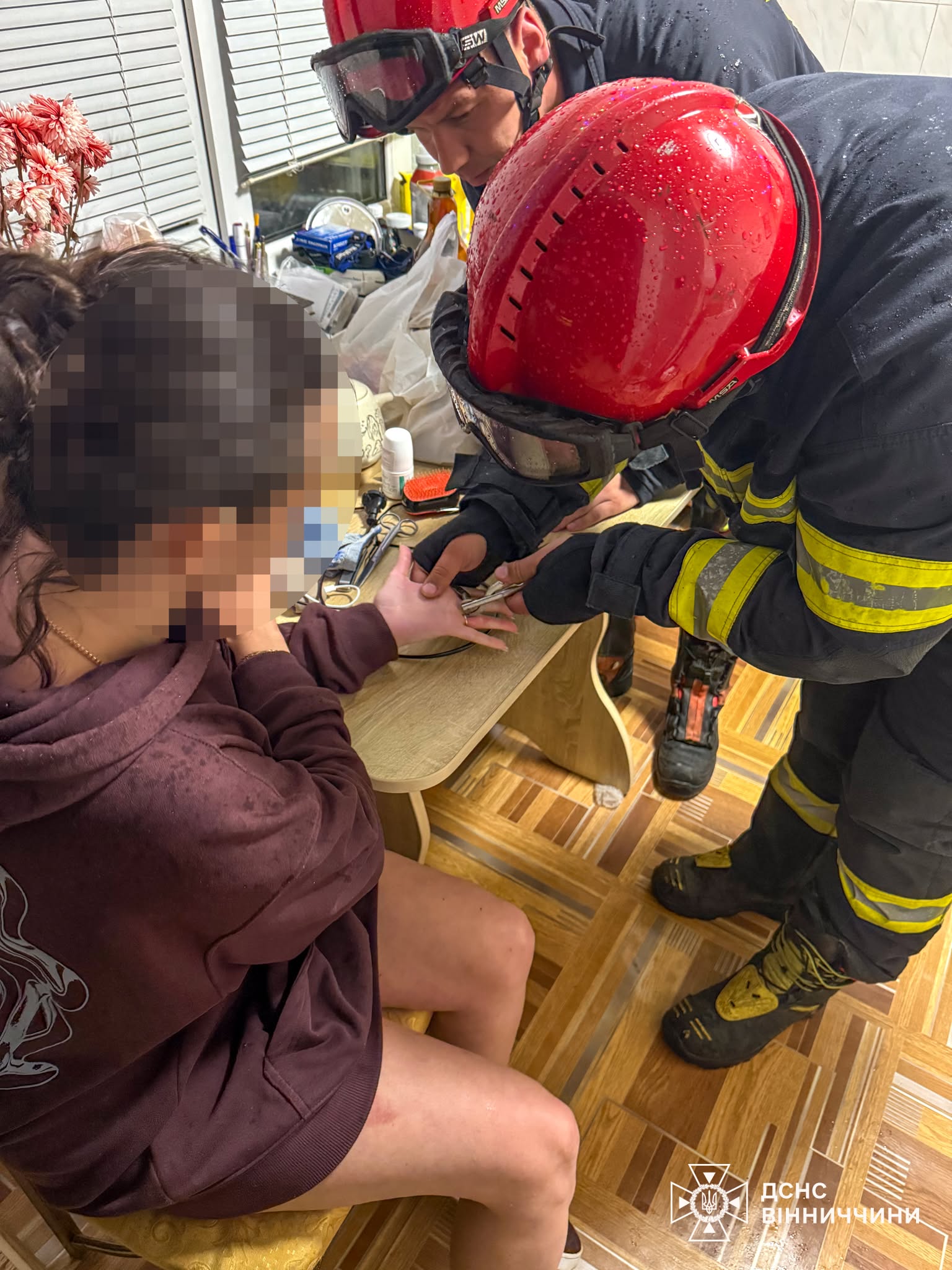 Надзвичайники провели «ювелірну» операцію з порятунку пальця вінничанки
