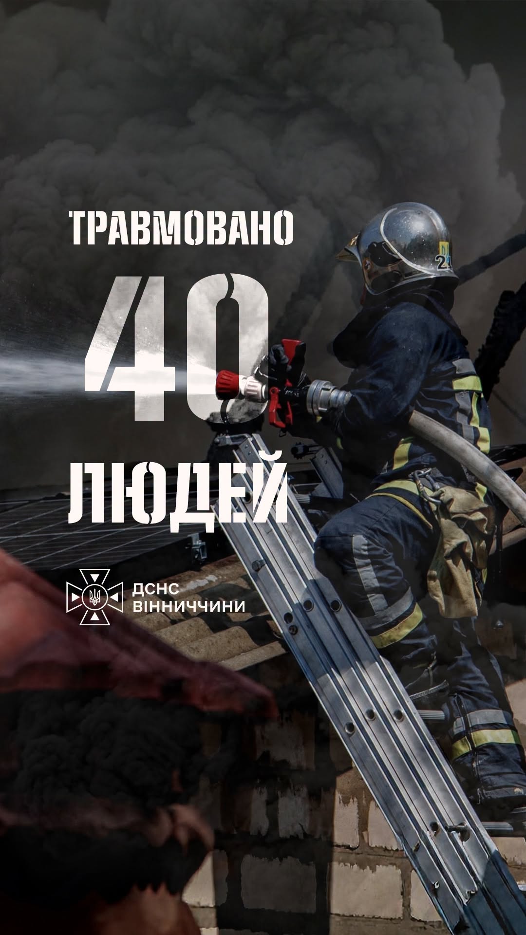 З початку року на території Вінницької області під час пожеж травмувалися 40 людей