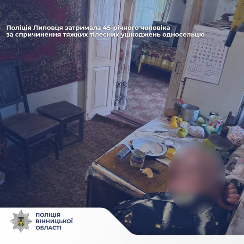 Побив односельця до важкого стану: поліція затримала 45-річного зловмисника